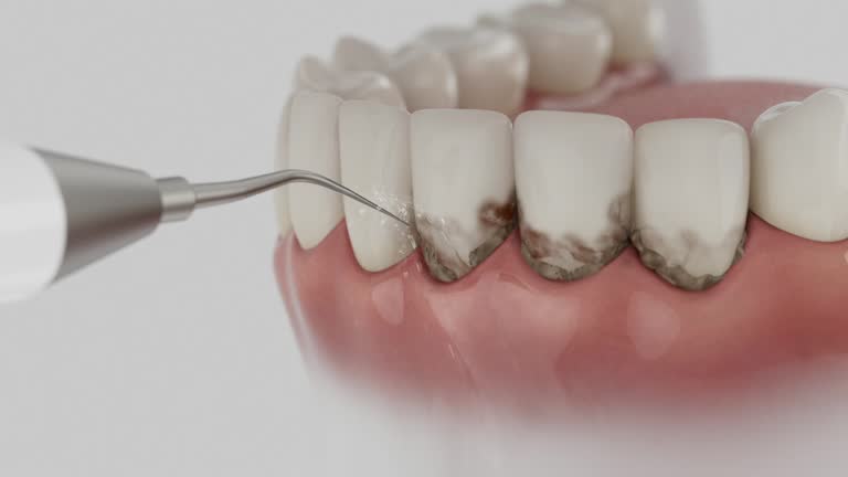Reliable Dental contractor in Bluffton, OH by Dentist Open Now